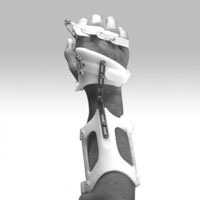 Upper oxtremity orthosis.