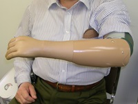 We custom fabricate Myoelectric Upper Limb Prosthetic devices.